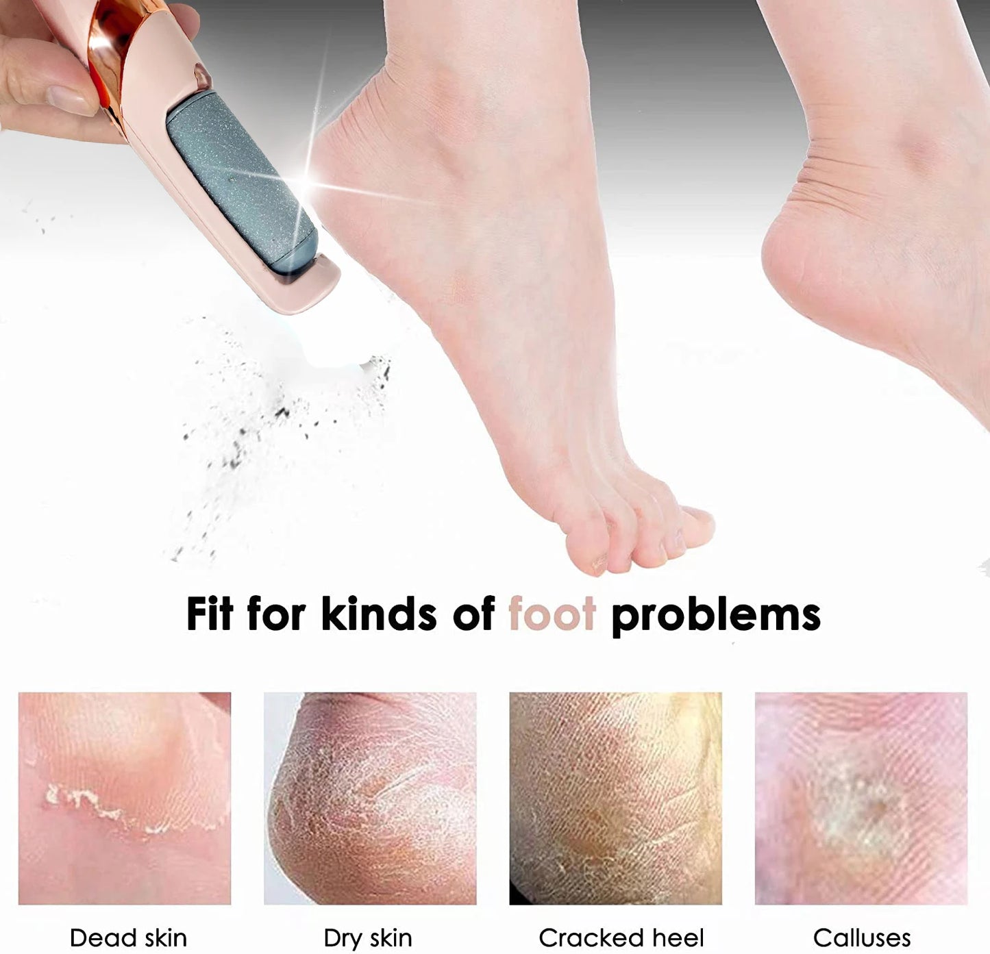 Flawless Pedi™ Electronic Pedicure Tool