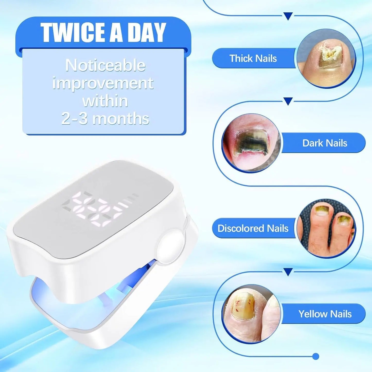 MycoBeam™ Laser Nail Therapy Device