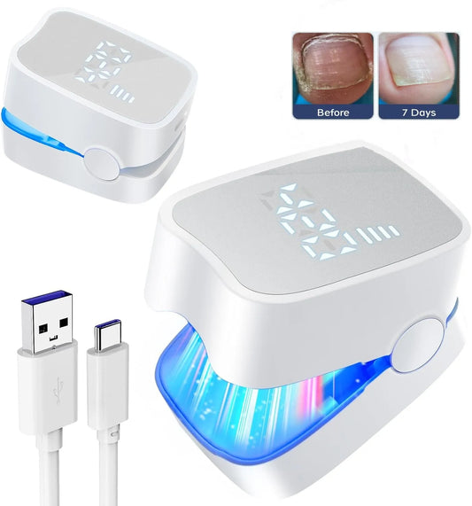 MycoBeam™ Laser Nail Therapy Device