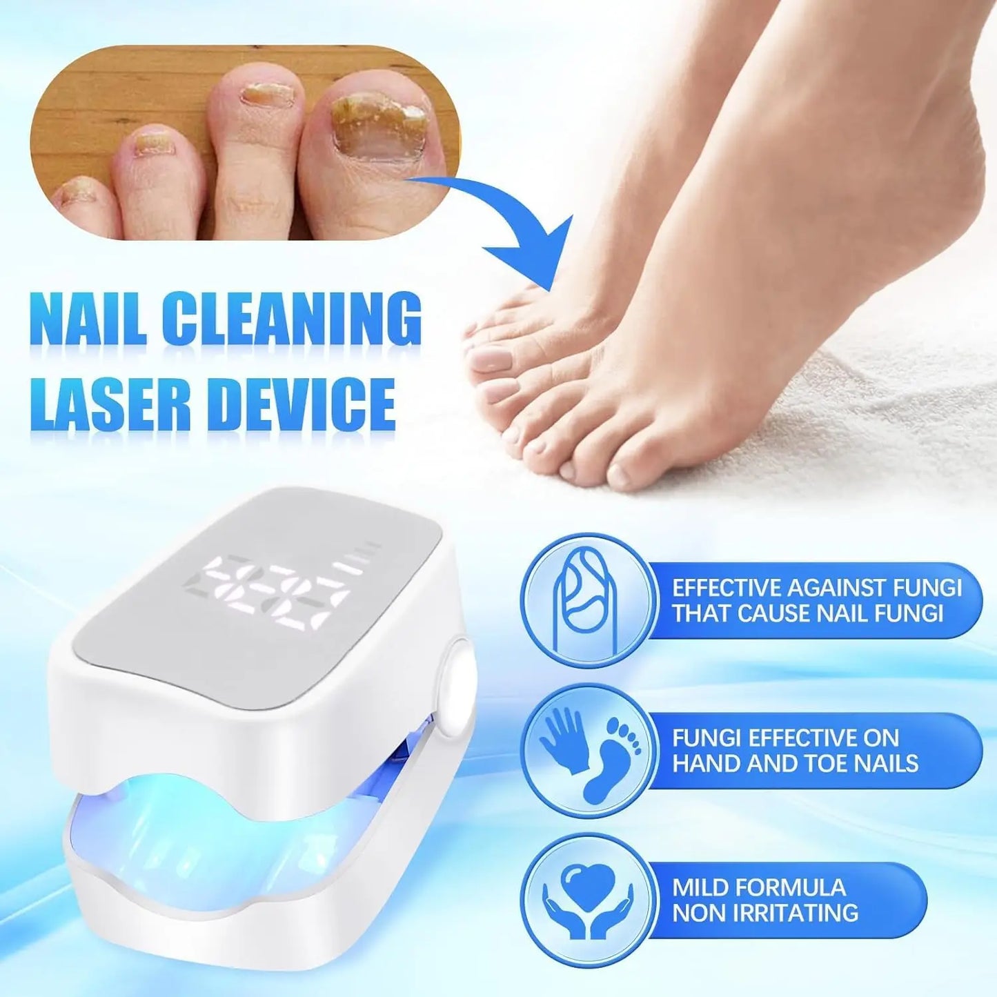 MycoBeam™ Laser Nail Therapy Device